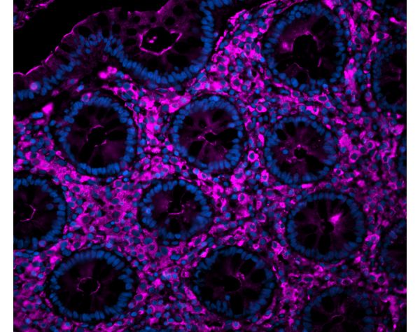 Sambucus Nigra Lectin (SNA, EBL), CY?5