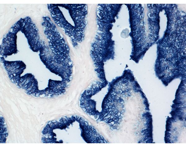BCIP/NBT Substrate Kit, Alkaline Phosphatase (AP), (5-bromo-4-chloro-3-indolyl phosphate/nitroblue tetrazolium)