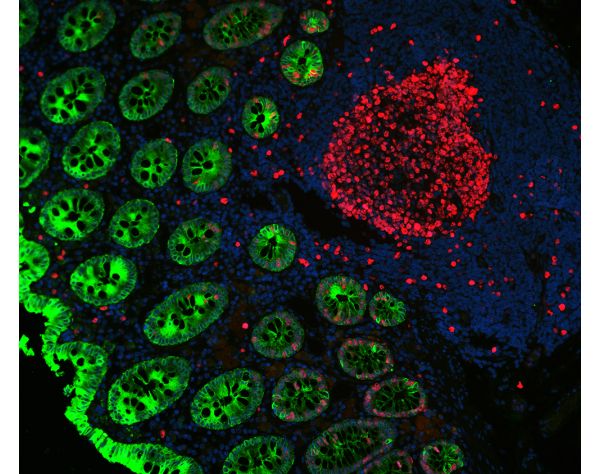 VectaFluor™ Duet Immunofluorescence Double Labeling Kit, DyLight? 594 Anti-Rabbit (red), DyLight? 488 Anti-Mouse (green)