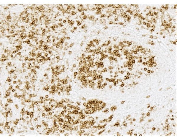 ImmPRESS? HRP Horse Anti-Rabbit IgG PLUS Polymer Kit, Peroxidase