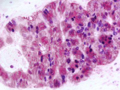 ImmPRESS?-AP Goat Anti-Rat IgG Polymer Detection Kit, Alkaline Phosphatase