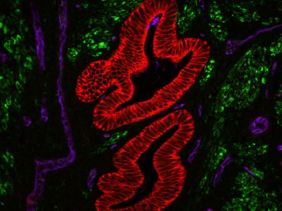 VECTASHIELD? HardSet™ Antifade Mounting Medium with DAPI