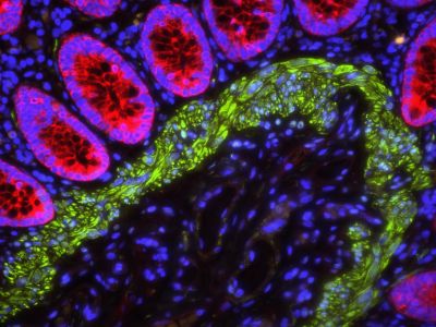VECTASHIELD? HardSet™ Antifade Mounting Medium with DAPI