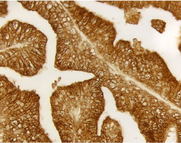 ImmPACT? DAB Substrate, Peroxidase (HRP)