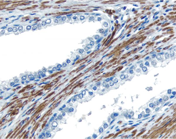 VECTASTAIN? Universal Quick HRP Kit, Peroxidase (Concentrate)