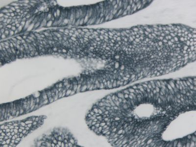 VECTASTAIN? Elite ABC-HRP Kit, Peroxidase, R.T.U. (Universal)