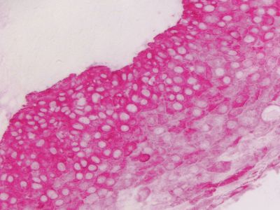 VECTASTAIN? ABC-AP Kit, Alkaline Phosphatase (Mouse IgG)