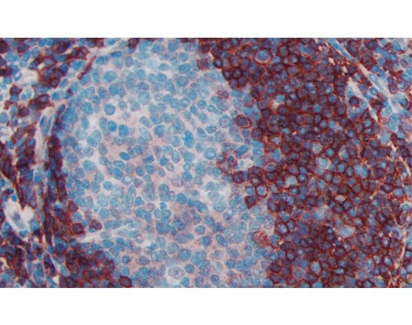 ImmPRESS? HRP Goat Anti-Rat IgG, Mouse adsorbed Polymer Detection Kit, Peroxidase