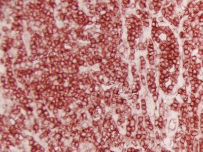 ImmPRESS? HRP Goat Anti-Rat IgG, Mouse adsorbed Polymer Detection Kit, Peroxidase