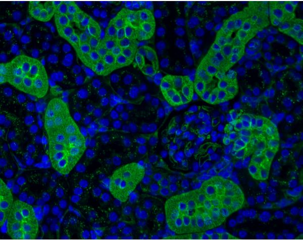 Lycopersicon Esculentum (Tomato) Lectin (LEL, TL), DyLight? 488