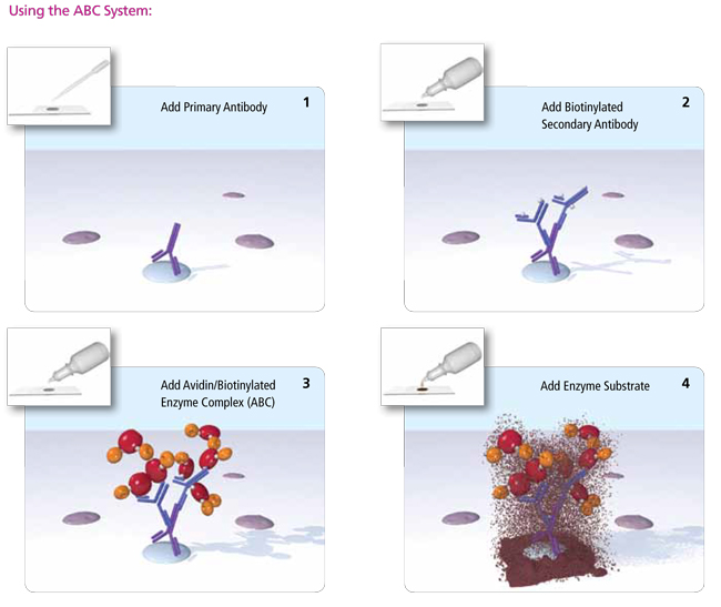 VECTASTAIN? Elite ABC-HRP Kit, Peroxidase (Rat IgG)
