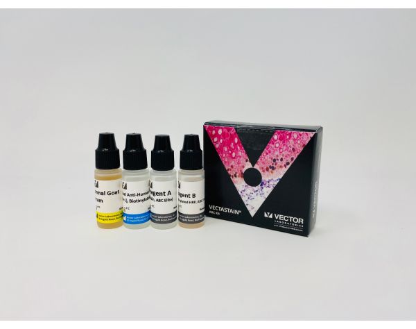 VECTASTAIN? Elite ABC-HRP Kit, Peroxidase (Human IgG)