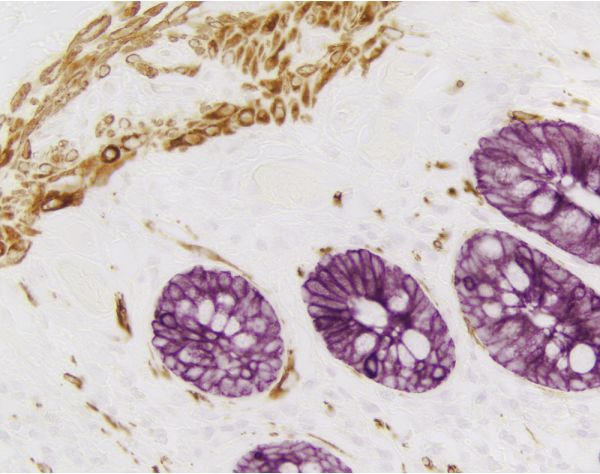 VECTASTAIN? Elite ABC-HRP Kit, Peroxidase (Mouse IgG)