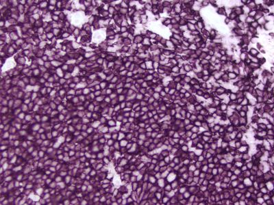 VECTASTAIN? Elite ABC-HRP Kit, Peroxidase (Mouse IgG)