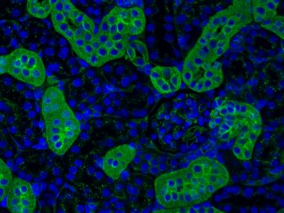 Lycopersicon esculentum (Tomato) Lectin (LEL, TL), Fluorescein