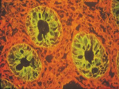 Lycopersicon esculentum (Tomato) Lectin (LEL, TL), Fluorescein