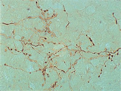 Goat Anti-Phaseolus Vulgaris Agglutinin (E+L), Unconjugated