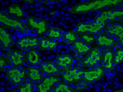 Aleuria Aurantia Lectin (AAL), Agarose bound