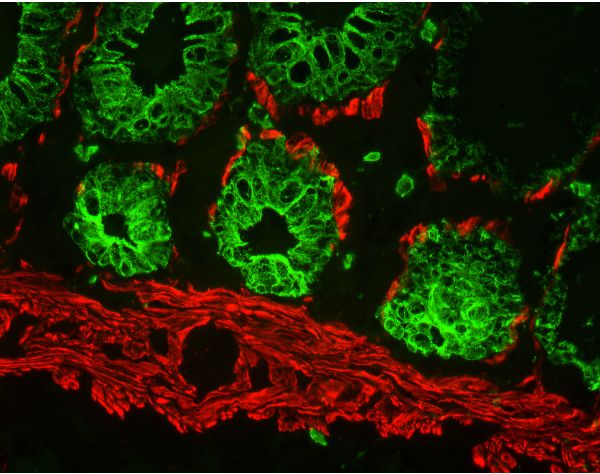 M.O.M.? (Mouse on Mouse) Blocking Reagent