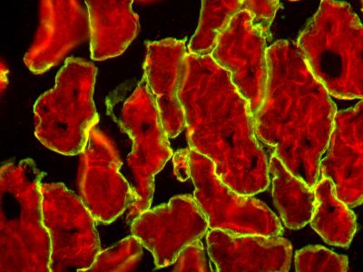 M.O.M.? (Mouse on Mouse) Blocking Reagent