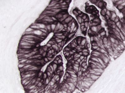 Streptavidin, Alkaline Phosphatase