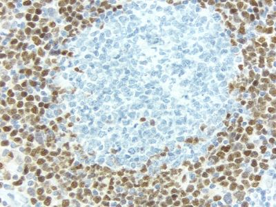 Rat IgG, Control Antibody