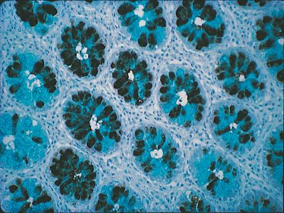 N-acetylgalactosamine