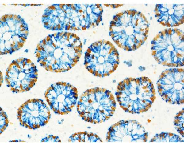 VectaMount? Express Mounting Medium